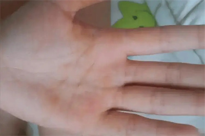 图片细节